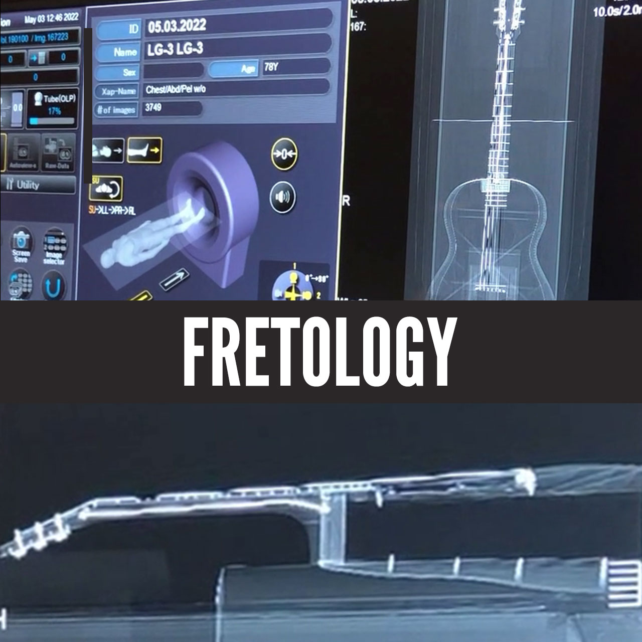 Fretology